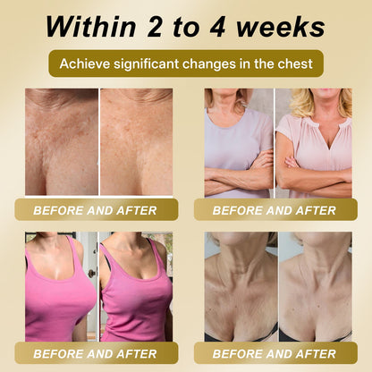 Official Online Offer | CleraLuxe® 💎 ROYAL JELLY FIRMING & LIFT PATCH - Safe to use during breastfeeding – suitable for concerns such as underdeveloped breasts, sagging, flatness, skin creasing, and nipple pigmentation.